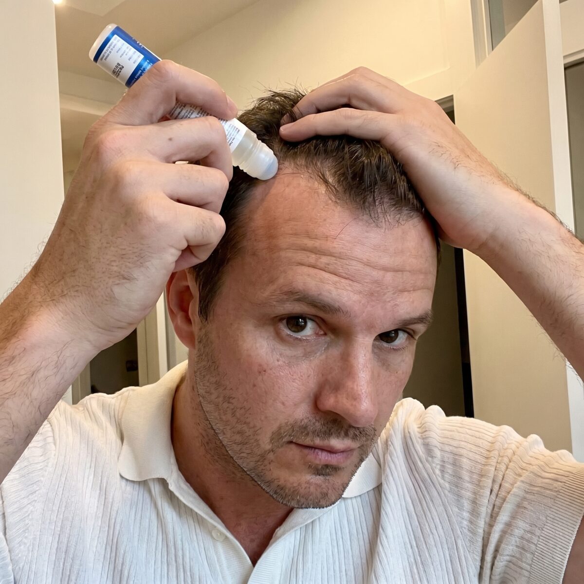 Aplicând roll-on-ul direct pe scalp, pe zonele unde părul se subția